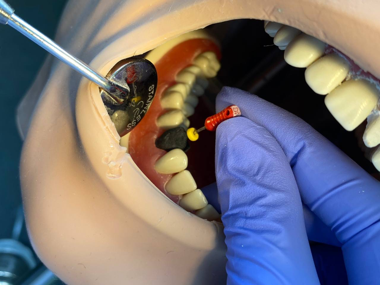 Разработка эндодонтического блока для отработки практических навыков студентов-стоматологов
